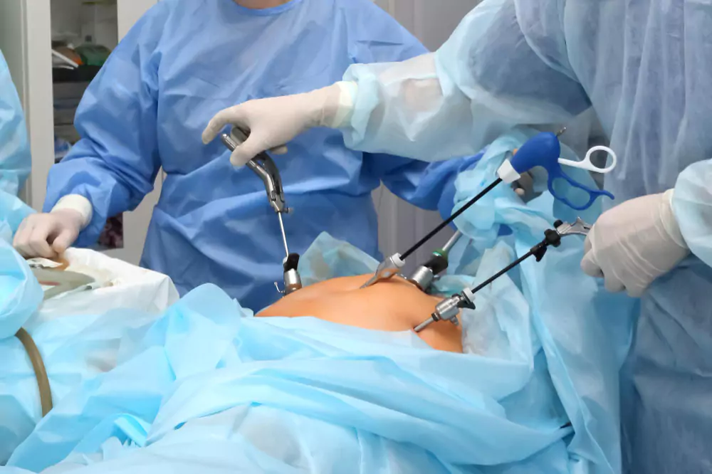 Laparoscopic Surgery (Keyhole Surgery)