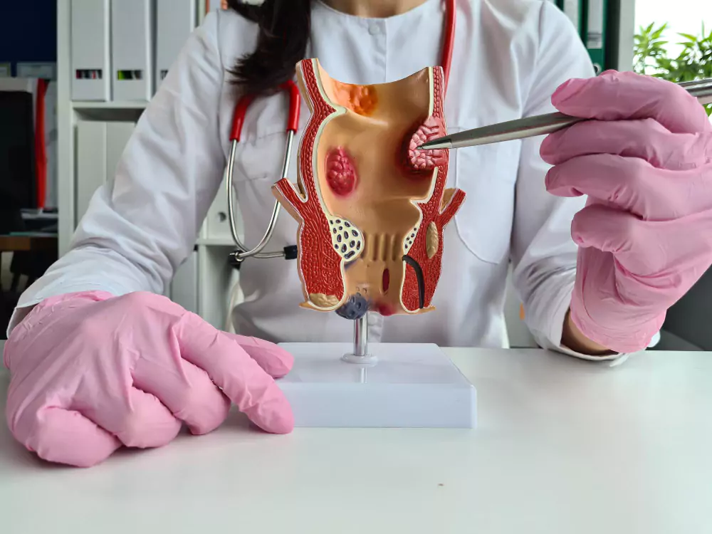 Advanced Laser Procedures for Colorectal Diseases
